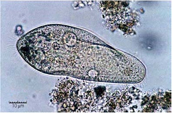 来自二次污泥的典型微生物。